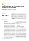 Научная статья на тему 'A clinical case of pityriasis rubra pilaris juvenile type'