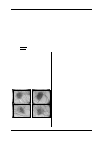 Научная статья на тему 'An efficient block-based algorithm for hair removal in dermoscopic images'