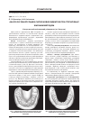 Научная статья на тему 'Анализ объемной усадки силиконовых оттисков при дезинфекции химическим методом'
