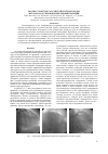 Научная статья на тему 'Анализ структуры сосудистой системы сердца методом трассировки изображений проекций'