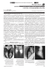 Научная статья на тему 'Ангиография кровеносных сосудов пальцев у коров с поражениями копытец'