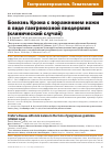 Научная статья на тему 'БОЛЕЗНЬ КРОНА С ПОРАЖЕНИЕМ КОЖИ В ВИДЕ ГАНГРЕНОЗНОЙ ПИОДЕРМИИ (КЛИНИЧЕСКИЙ СЛУЧАЙ)'