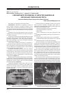 Научная статья на тему 'Circumstance for removal of impacted mandibular second and third molars teeth'