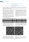 Научная статья на тему 'Development of the methods for production of absorbing carbon nanoporous materials with the healing effect'