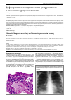 Научная статья на тему 'Дифференциальная диагностика деструктивных и полостных процессов в легких'