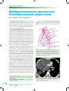 Научная статья на тему 'Дифференциальная диагностика новообразований средостения'