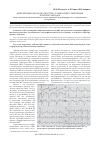 Научная статья на тему 'Дифференциальная диагностика тахикардий с широкими комплексами QRS'