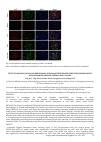 Научная статья на тему 'Effect of Qiangxin Capsule on endoplasmic reticulum stress related perk-eif2α pathway in rats with adriamycin-induced chronic heart failure'