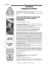 Научная статья на тему 'EX VIVO STUDY OF THE KINETICS OF OVARIAN TISSUE OPTICAL PROPERTIES UNDER THE INFLUENCE OF 40%-GLUCOSE'