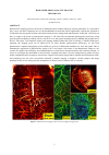 Научная статья на тему 'HIGH SPEED PHOTOACOUSTIC IMAGING '