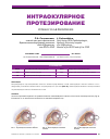 Научная статья на тему 'Интраокулярное протезирование'