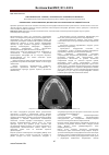 Научная статья на тему 'Компьютерно-томографическая диагностика патологии челюстно-лицевой области'