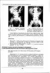 Научная статья на тему 'Лечение пузырно-мочеточникового рефлюкса в гипоплазированную или вторично-сморщенную почку'