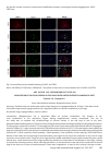 Научная статья на тему 'Localization of calcium cations in the lungs with antiorthostatic hanging of rats'