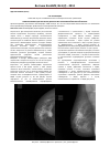 Научная статья на тему 'Маммография и дуктография в диагностике заболеваний молочной железы'
