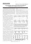 Научная статья на тему 'МНОЖЕСТВЕННЫЕ ЭЛЕКТРОКАРДИОГРАФИЧЕСКИЕ ПРОЯВЛЕНИЯ НАРУШЕНИЙ В ЭЛЕКТРОКАРДИОСТИМУЛЯТОРЕ «ЮНИОР»'
