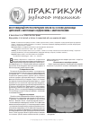 Научная статья на тему 'Мостовидный протез передних зубов на основе диоксида циркония с винтовым соединением с имплантатами'