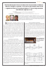 Научная статья на тему 'Optimization of Pro= duction technology for spring spandrel beam castings for freight= car Trucks using computer simulation of foundry processes'