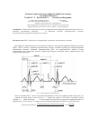 Научная статья на тему 'Основная характеристика цифровой обработки сигнала для кардиосигналов'
