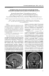 Научная статья на тему 'Первый опыт транссфеноидальной хирургии новообразований хиазмально-селлярной области'