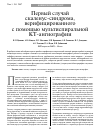 Научная статья на тему 'Первый случай скаленус-синдрома, верифицированного с помощью мультиспиральной КТ-ангиографии'