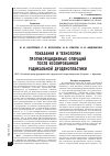 Научная статья на тему 'Показания и технологии противорецидивных операций после изолированной радикальной дуоденопластики'