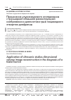 Научная статья на тему 'Применение ультразвукового исследования с трехмерной объемной реконструкцией изображения в диагностике грыж пищеводного отверстия диафрагмы'