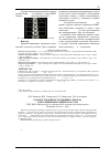 Научная статья на тему 'Распространенность дефицита железа у школьников младших классов'