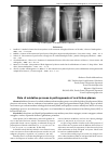 Научная статья на тему 'Role of oxidative process in pathogenesis of oral lichen planus'