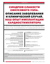 Научная статья на тему 'Синдром слабости синусового узла. Описание заболевания и клинический случай. Наш опыт имплантации кардиостимулятора'