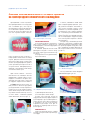 Научная статья на тему 'Система изготовления полных съемных протезов на примере одного клинического наблюдения'