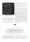 Научная статья на тему 'Случай энтеровирусной инфекции в форме менингомиелита у ребенка в возрасте 3-х лет'