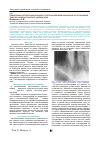 Научная статья на тему 'Сравнительная рентгенографическая оценка структурных изменений альвеолярной части тела нижней челюсти в различные сроки после удаления зубов'