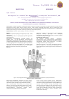 Научная статья на тему 'The experience of using two-stage autotendon plastics with long-term consequences of hand injuries'