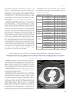 Научная статья на тему 'УСПЕШНАЯ ТЕРАПИЯ В-ОСТРОГО ЛИМФОБЛАСТНОГО ЛЕЙКОЗА И ЦЕНТРАЛЬНОГО ПЛОСКОКЛЕТОЧНОГО РАКА ЛЕГКИХ'