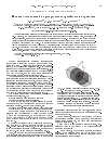 Научная статья на тему 'Влияние столкновений на распределение тромбоцитов в кровотоке'